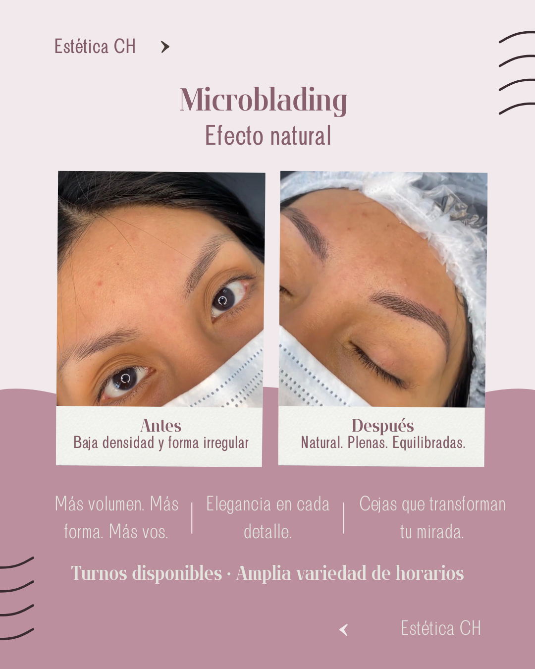 Perfilado de cejas en Recoleta - Centro de Estética en Recoleta